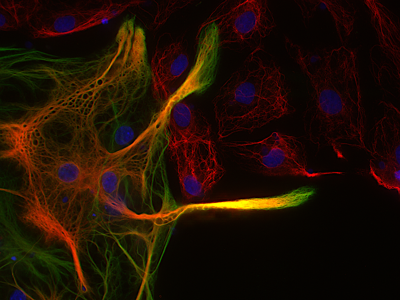 Vimentin, Polyclonal Guinea pig antiserum