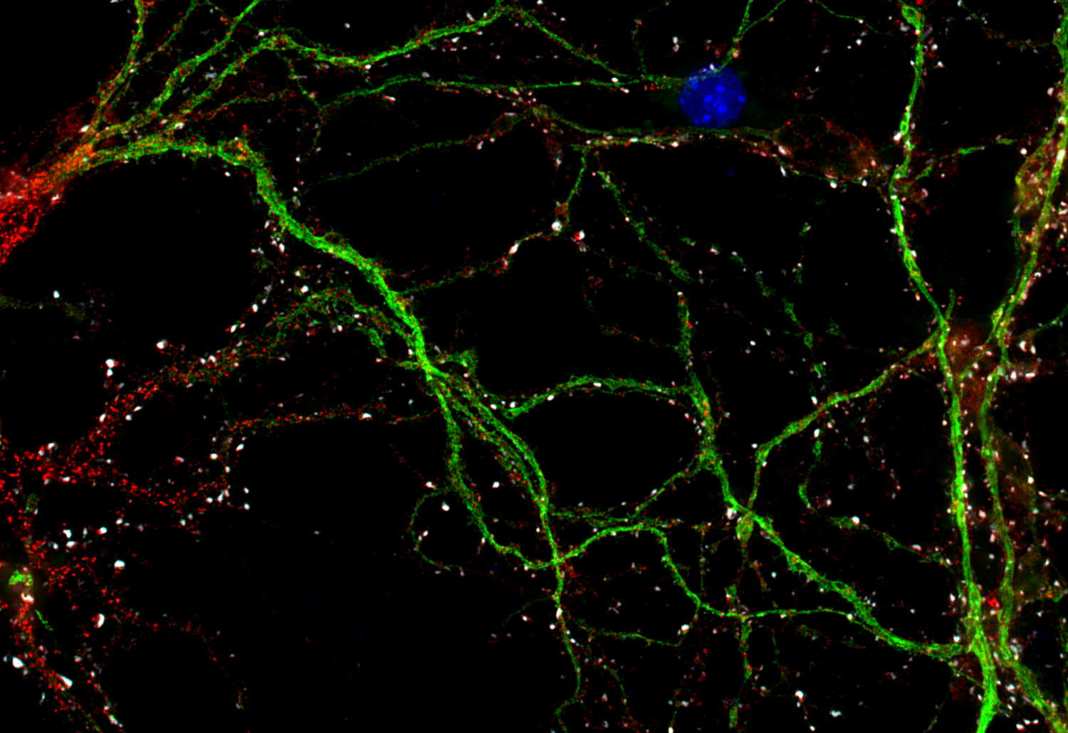GluA2 Recombinant rabbit - image 3