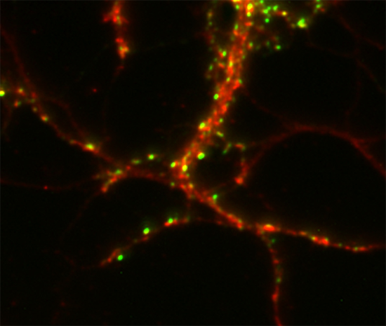 CASKIN1, Polyclonal rabbit antiserum