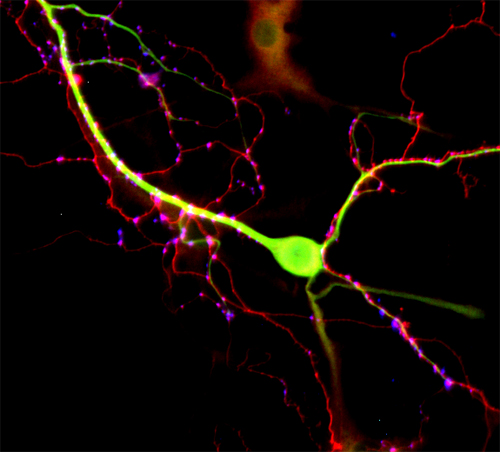 MAP2 Polyclonal rabbit antiserum - image 2