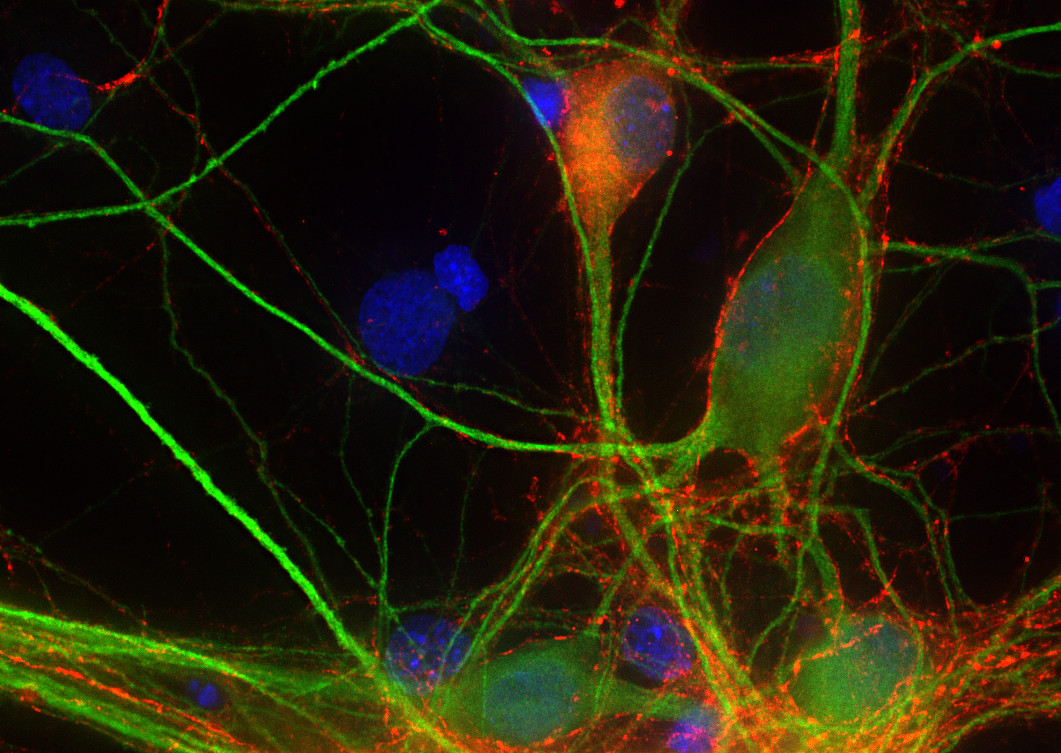 MAP2 Polyclonal rabbit antiserum - image 3