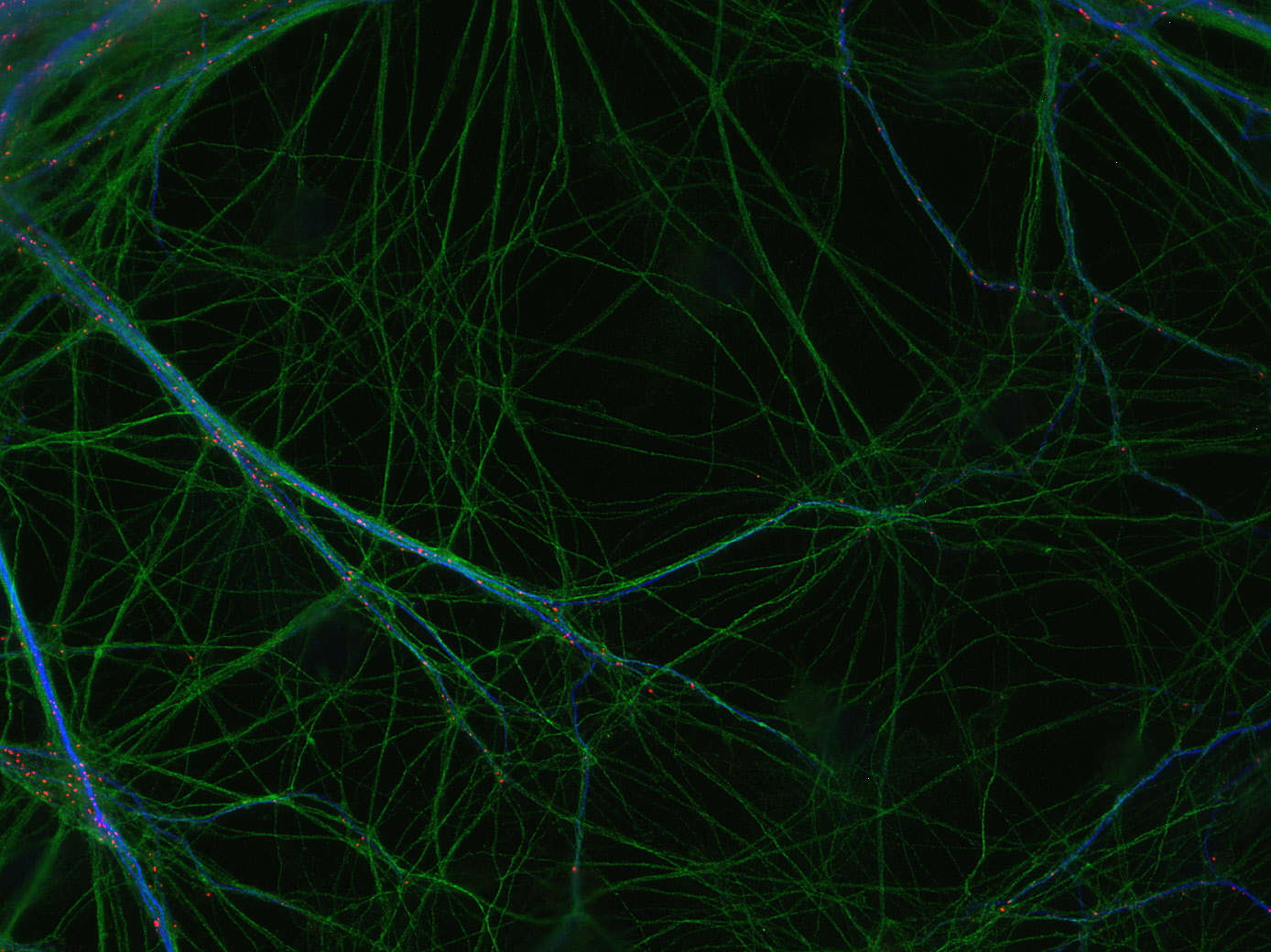 MAP2 Polyclonal rabbit antiserum - image 4