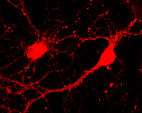 PACSIN1, Polyclonal rabbit antiserum