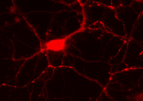 ZnT3, Polyclonal rabbit antiserum