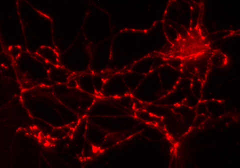 GAD2, Polyclonal rabbit antiserum