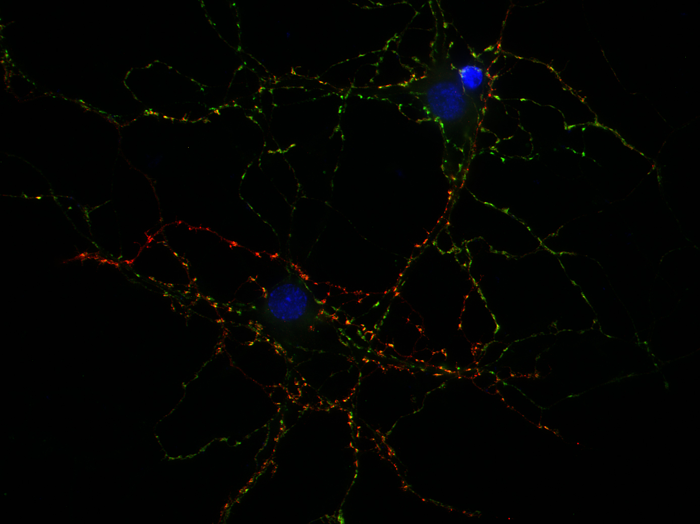 GAD2 / GAD65 Recombinant rabbit - image 2