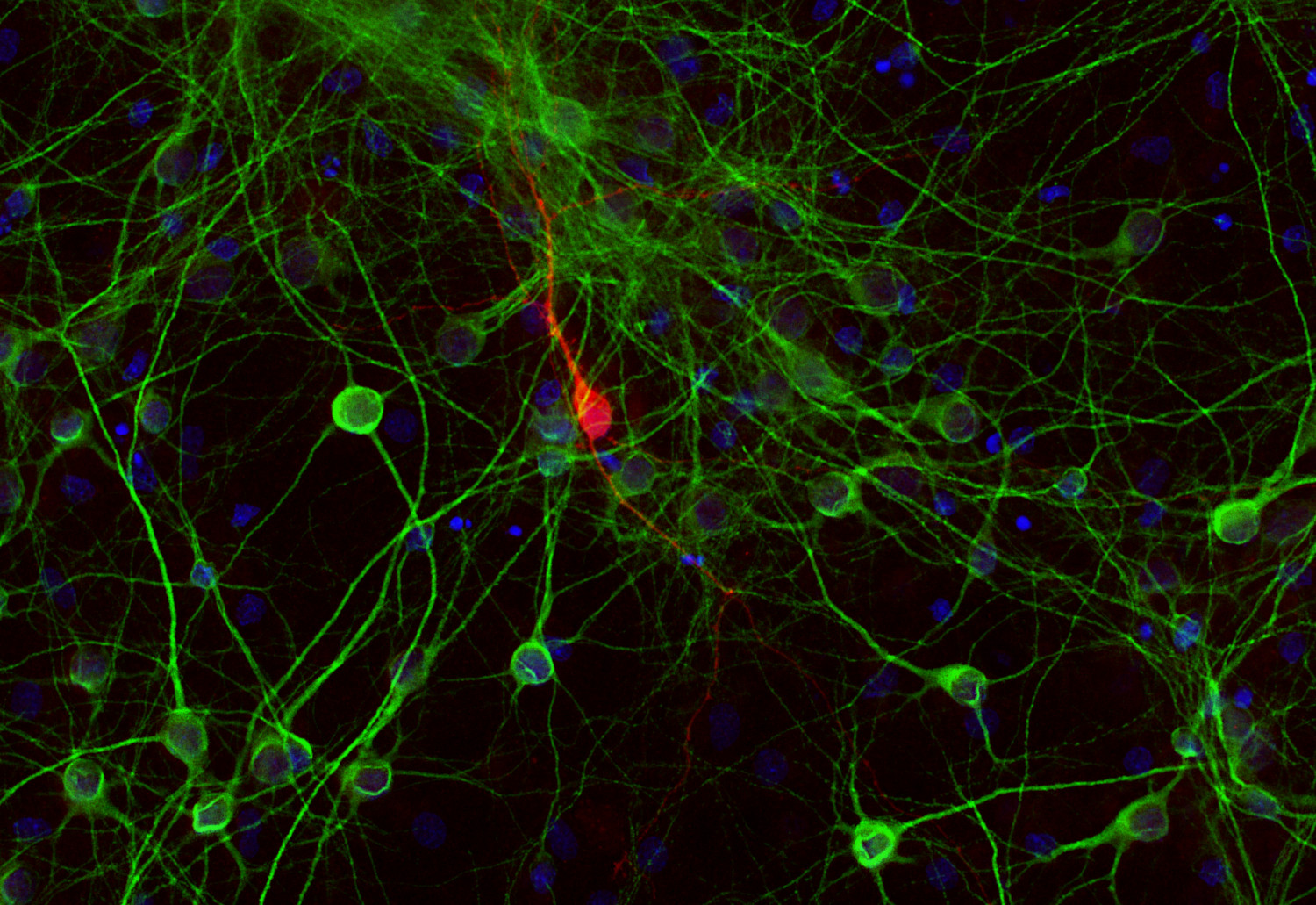 Tyrosine hydroxylase Recombinant rabbit - image 2