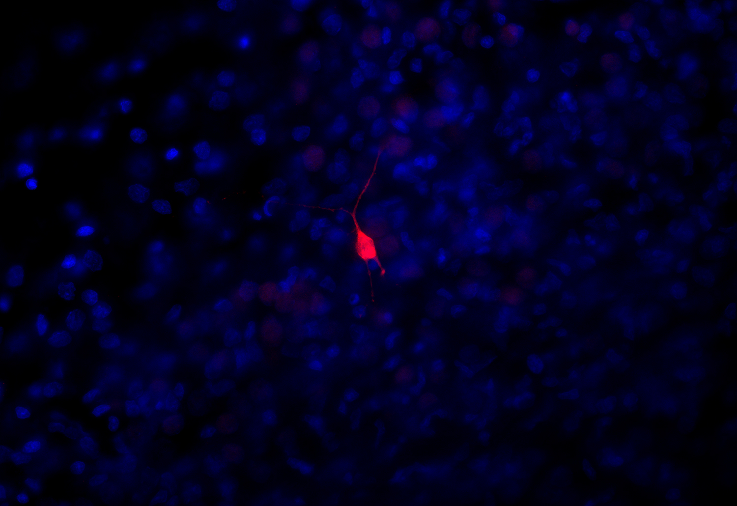 Tyrosine hydroxylase Recombinant Guinea pig - image 2
