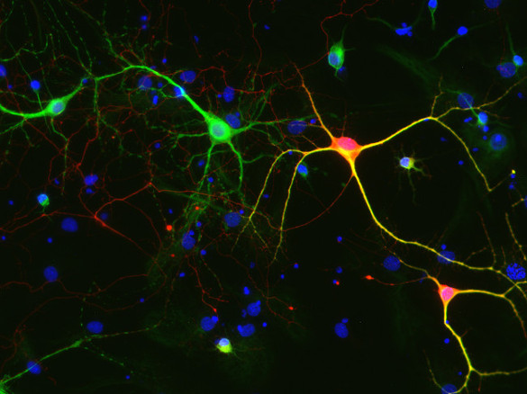 Calretinin Polyclonal Guinea pig antiserum - image 2