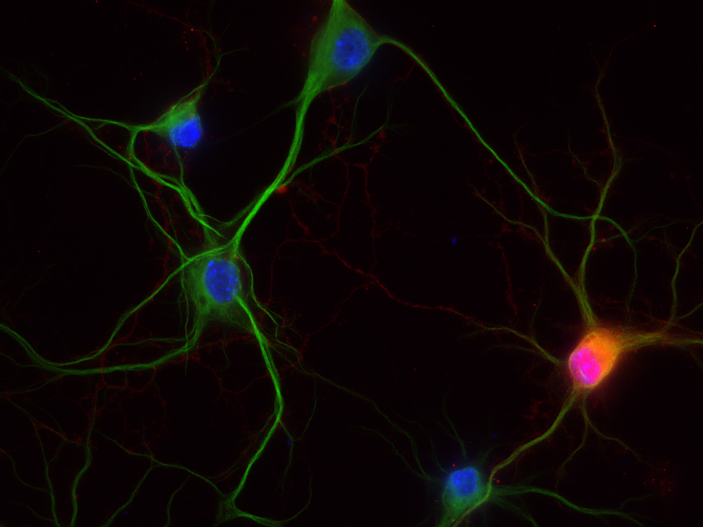 Calretinin Recombinant rabbit - image 2