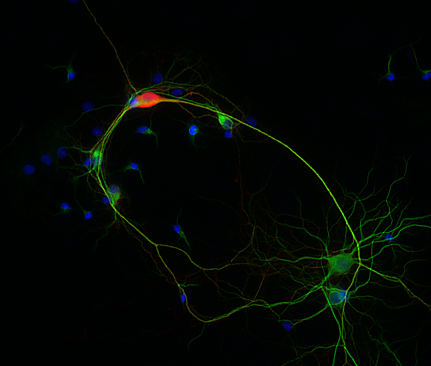 Calretinin Recombinant chicken - image 2