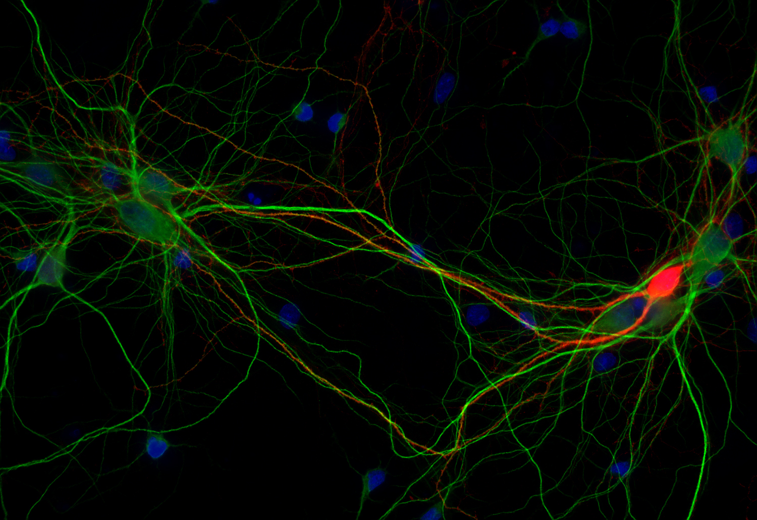 Calretinin Recombinant Guinea pig - image 2