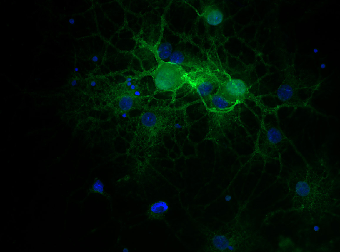 Tenascin-R Recombinant rabbit - image 2