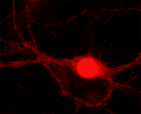 CtBP1 Polyclonal rabbit antiserum - image 2