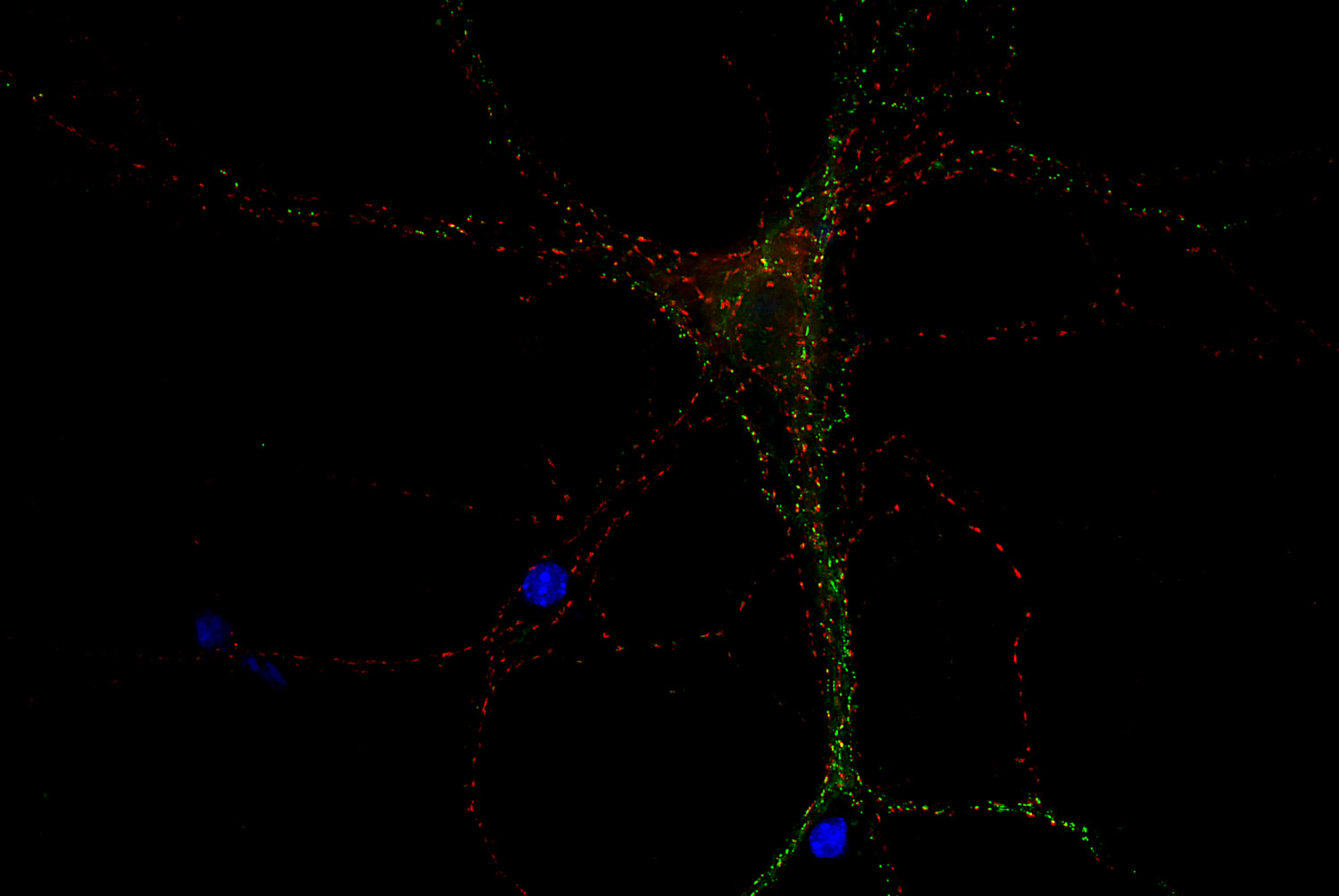 GABA-A receptor alpha1 Recombinant rabbit - image 1