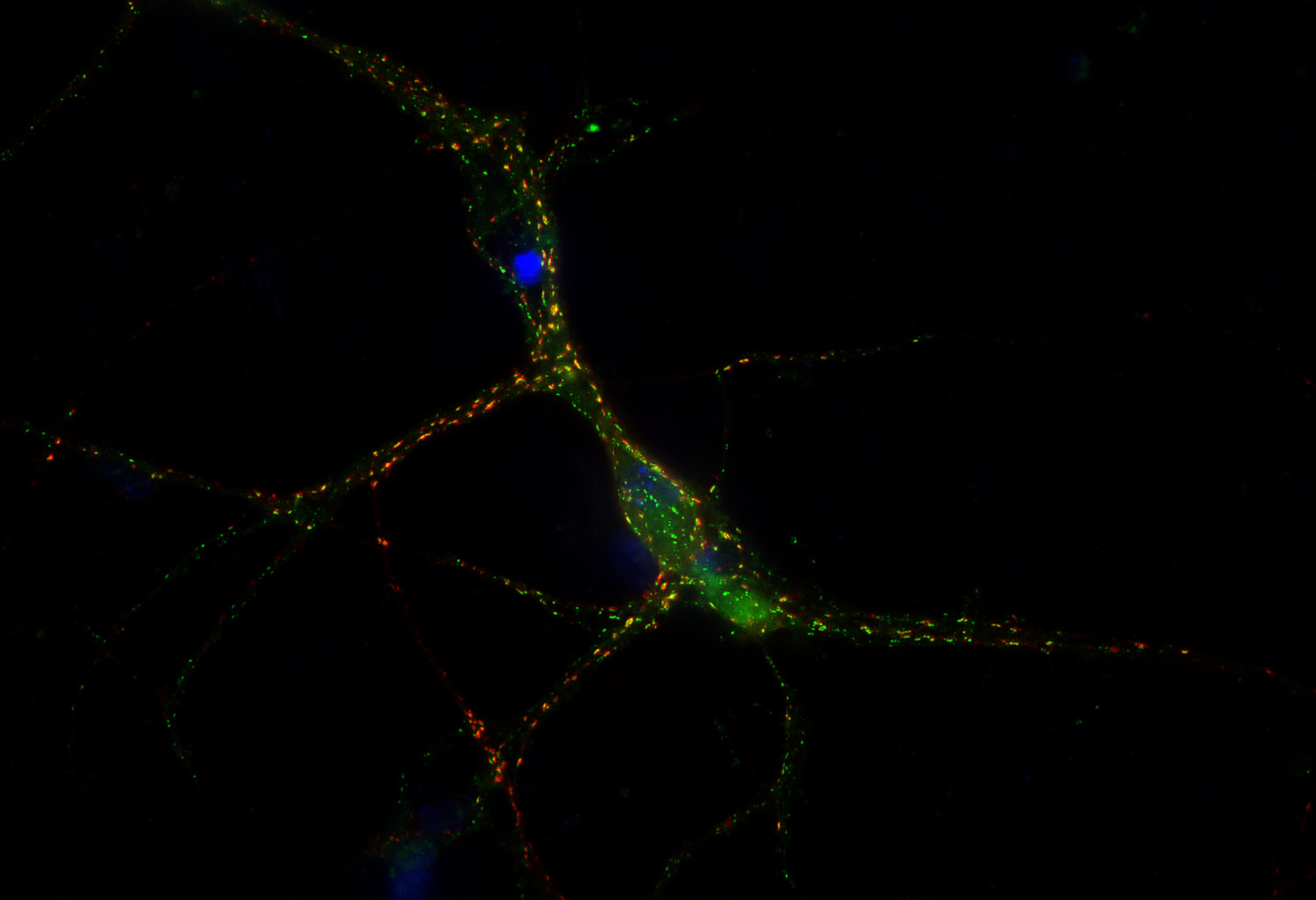 GABA-A receptor alpha1 Recombinant rabbit - image 2