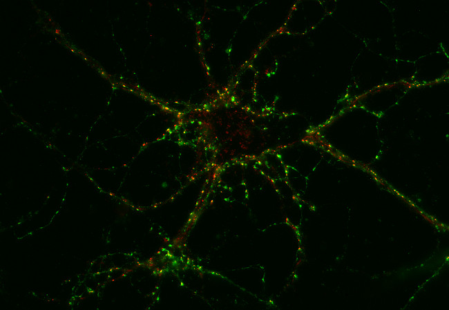 GABA-A receptor beta3 Monoclonal mouse purified IgG - image 1