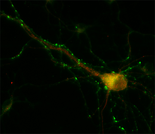 EEA1 Polyclonal rabbit antiserum - image 2