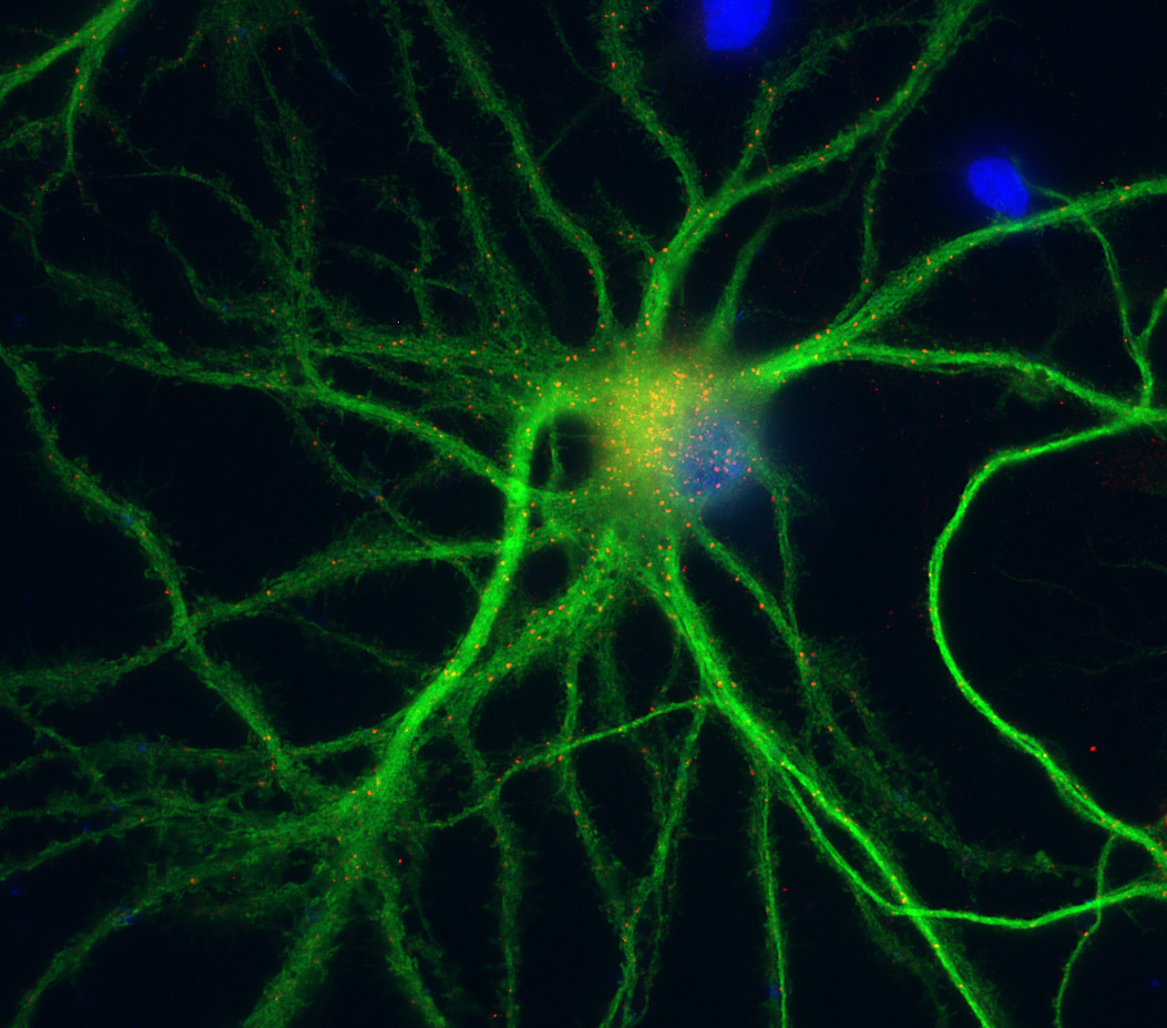 EEA1 Polyclonal rabbit antiserum - image 3