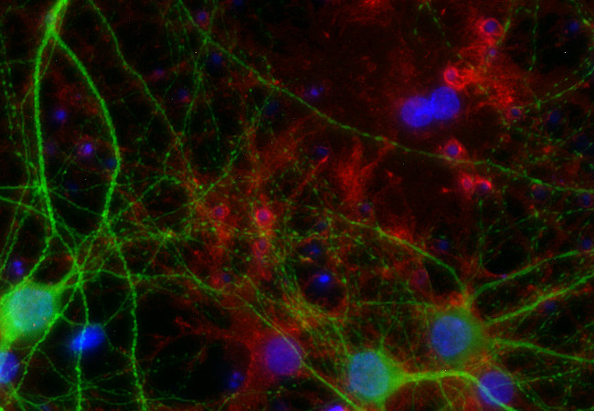 EAAT1 Polyclonal Guinea pig antiserum - image 2