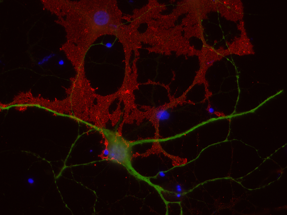 EAAT1 Polyclonal chicken IgY fraction - image 2