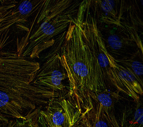 beta-Actin Polyclonal rabbit purified antibody - image 3