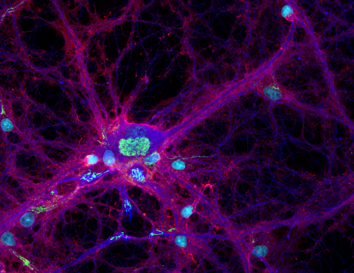 beta-Actin, Recombinant chicken