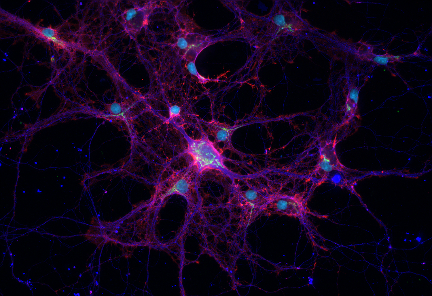 beta-Actin, Recombinant chicken