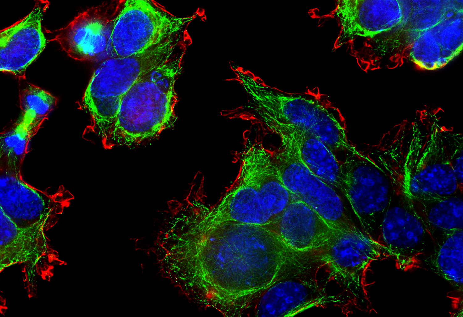 beta-Actin, Recombinant chicken