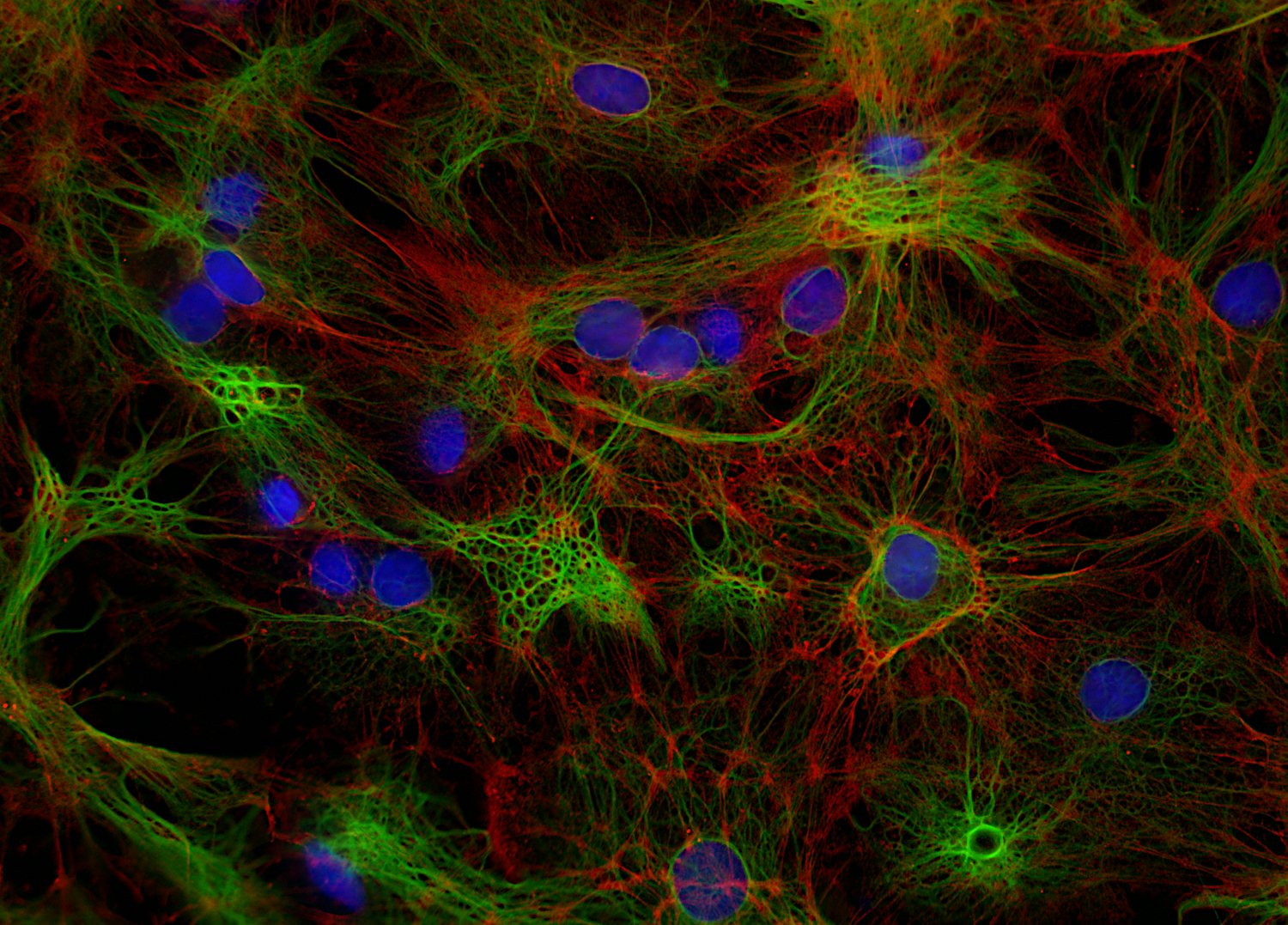 beta-Actin, Recombinant chicken