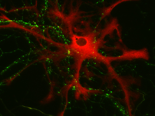 Glycogen phosphorylase Polyclonal rabbit purified antibody - image 2