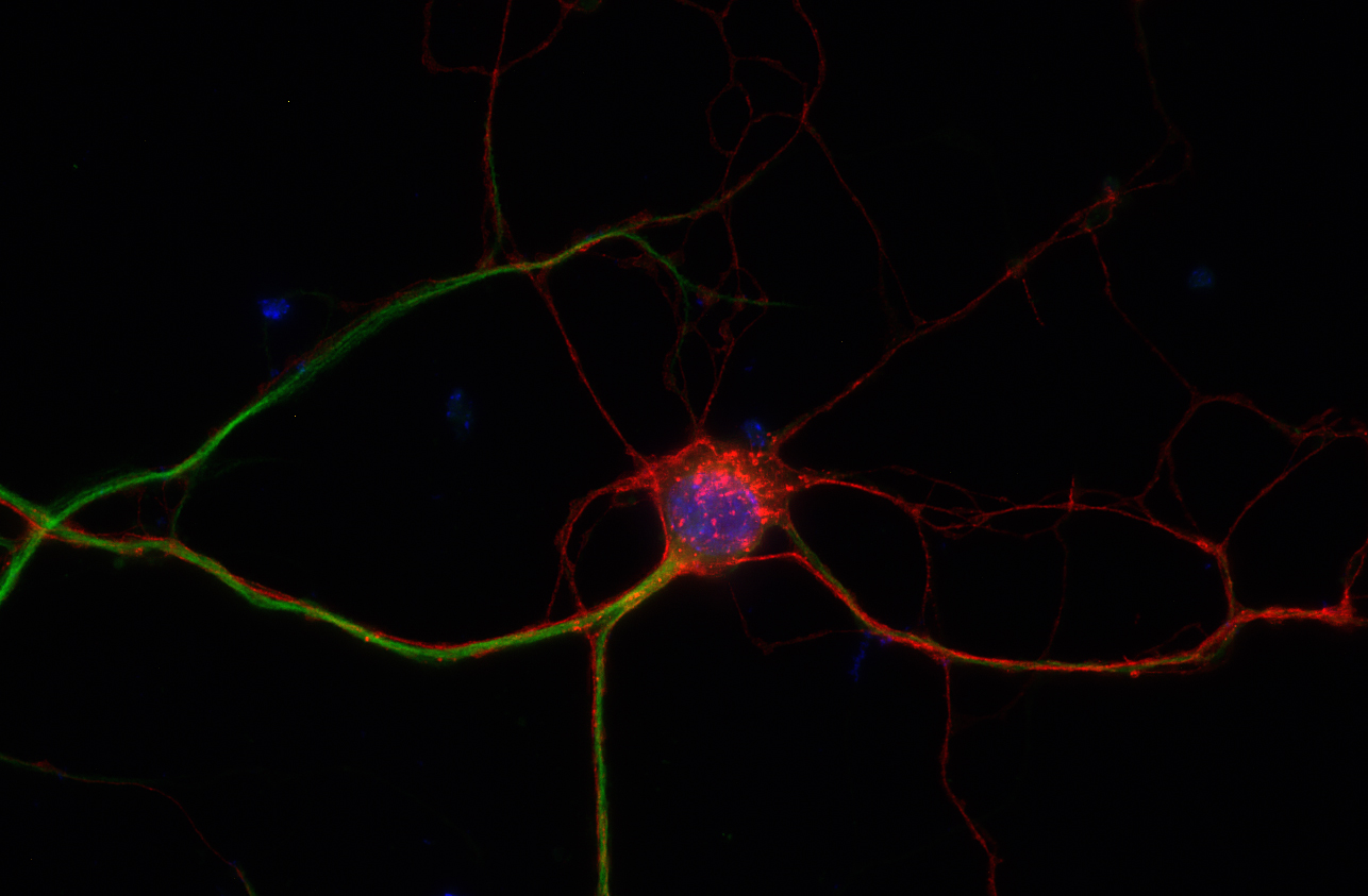 Cannabinoid receptor CB1-R Recombinant rabbit - image 1