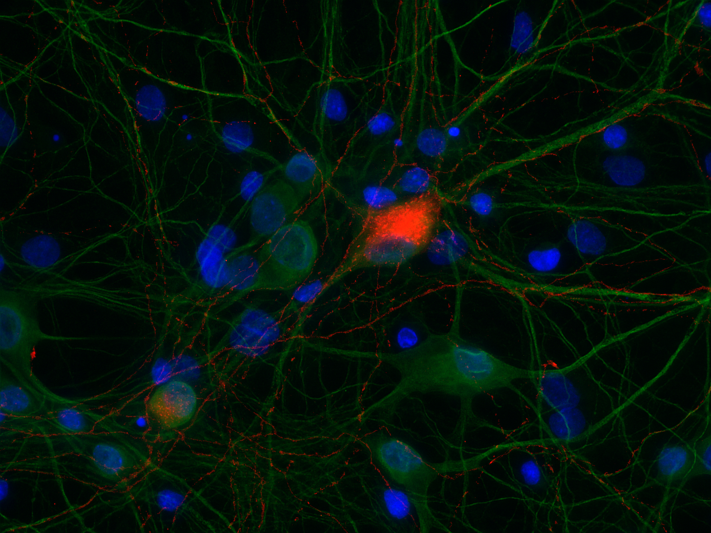 Cannabinoid receptor CB1-R Recombinant chicken - image 1