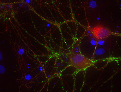 Cannabinoid receptor CB1-R Polyclonal Guinea pig antiserum - image 1