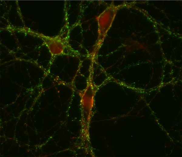 GABA transporter1 Polyclonal rabbit antiserum - image 2