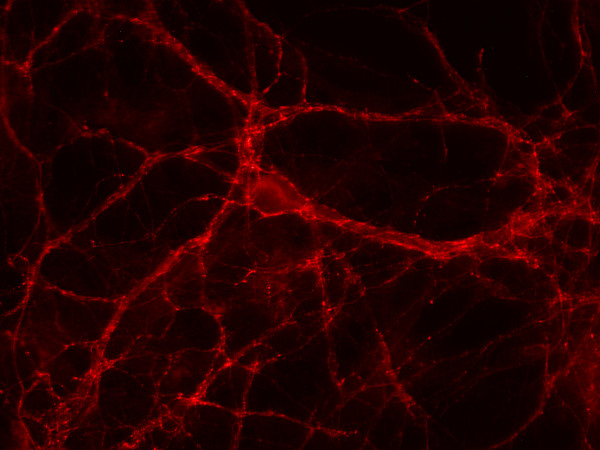 GABA transporter1 Polyclonal Guinea pig antiserum - image 2