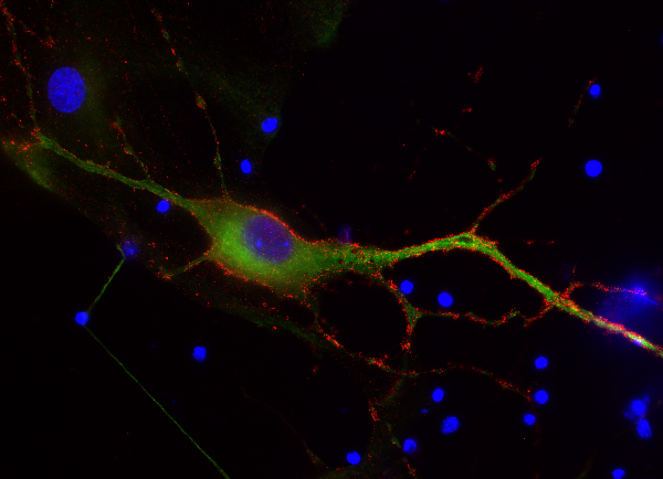 EPB41L1 / 4.1N Polyclonal rabbit purified antibody - image 2