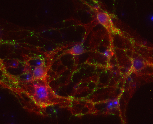 EPB41L2 / 4.1G Polyclonal rabbit antiserum - image 2