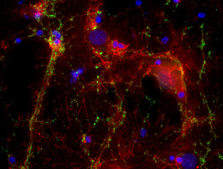 beta-Catenin Polyclonal Guinea pig antiserum - image 2