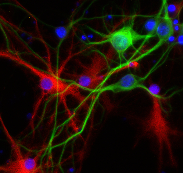 S100B Polyclonal Guinea pig antiserum - image 1