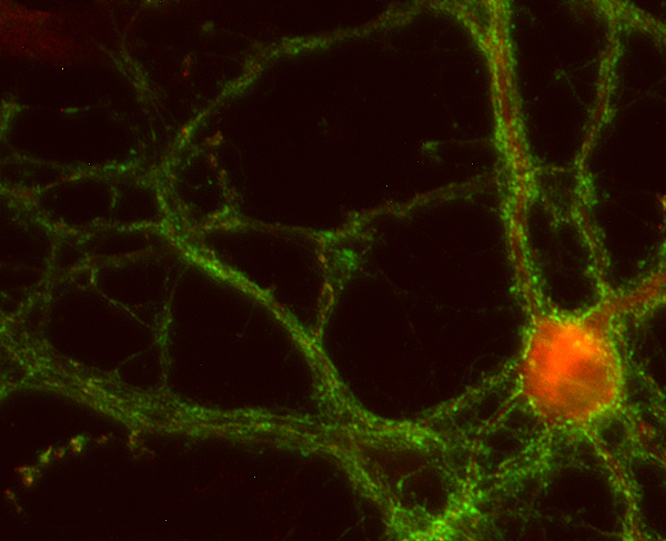 EPS8, Polyclonal rabbit purified antibody