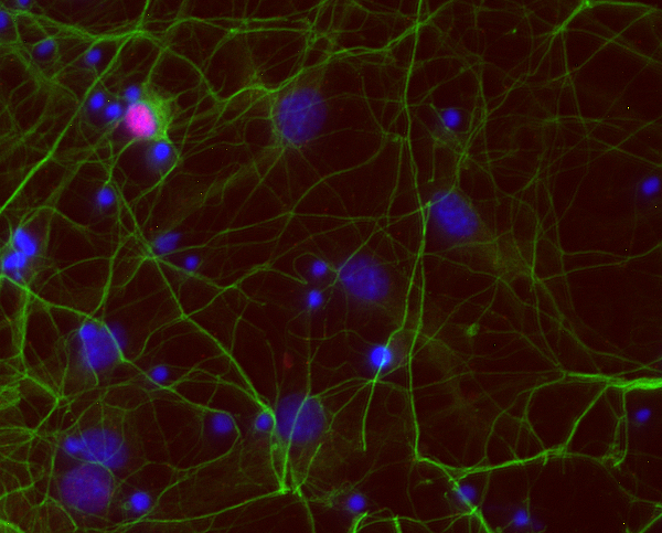 Olig2, Polyclonal rabbit purified antibody