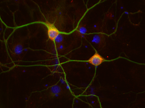 COX4 Polyclonal rabbit antiserum - image 2