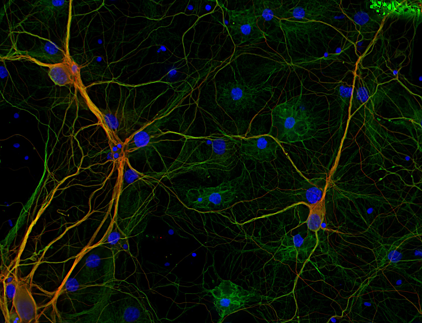 Glu-Tubulin Recombinant rabbit - image 2