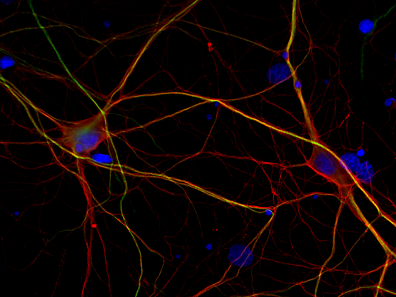 beta3-Tubulin Recombinant rabbit - image 2
