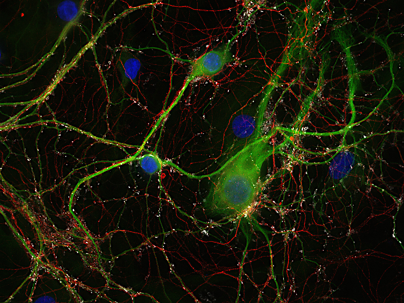 Tau, Polyclonal rabbit antiserum