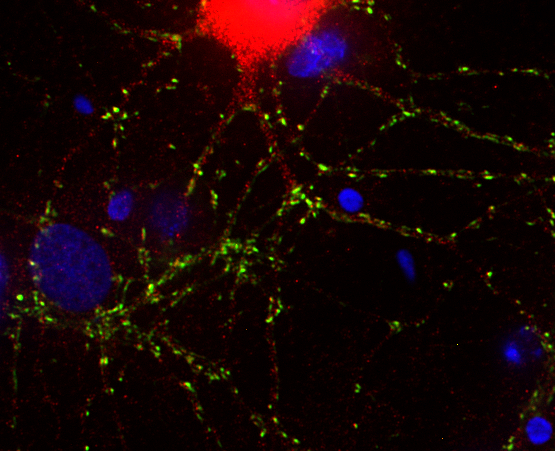 GABABR1, Polyclonal rabbit antiserum