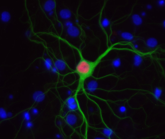 SATB2, Polyclonal Guinea pig antiserum