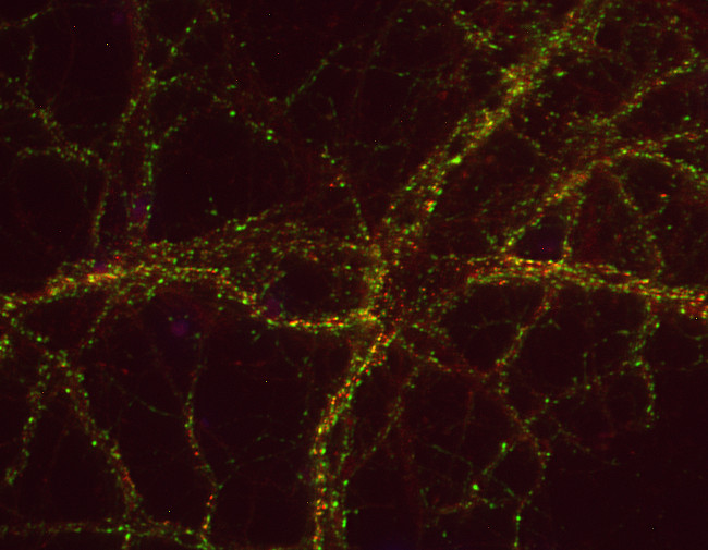 DAP1, Polyclonal Guinea pig antiserum