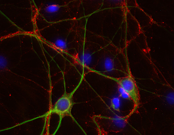 GAP43, Polyclonal rabbit antiserum